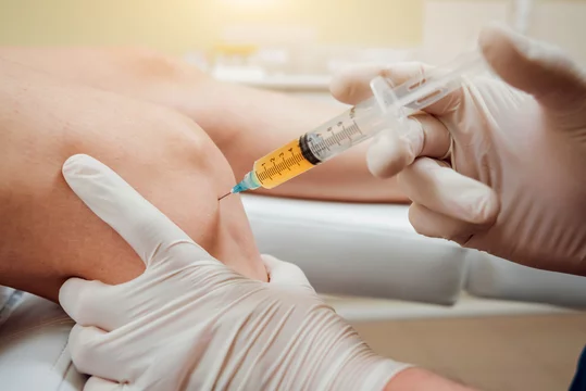 Exploring PRP Therapy at Wellness First Medical & Chiropractic Center